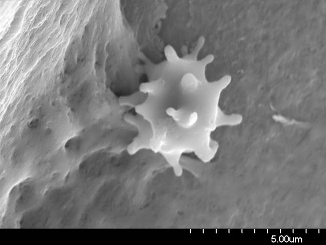 White Blood Cell on Biofilm